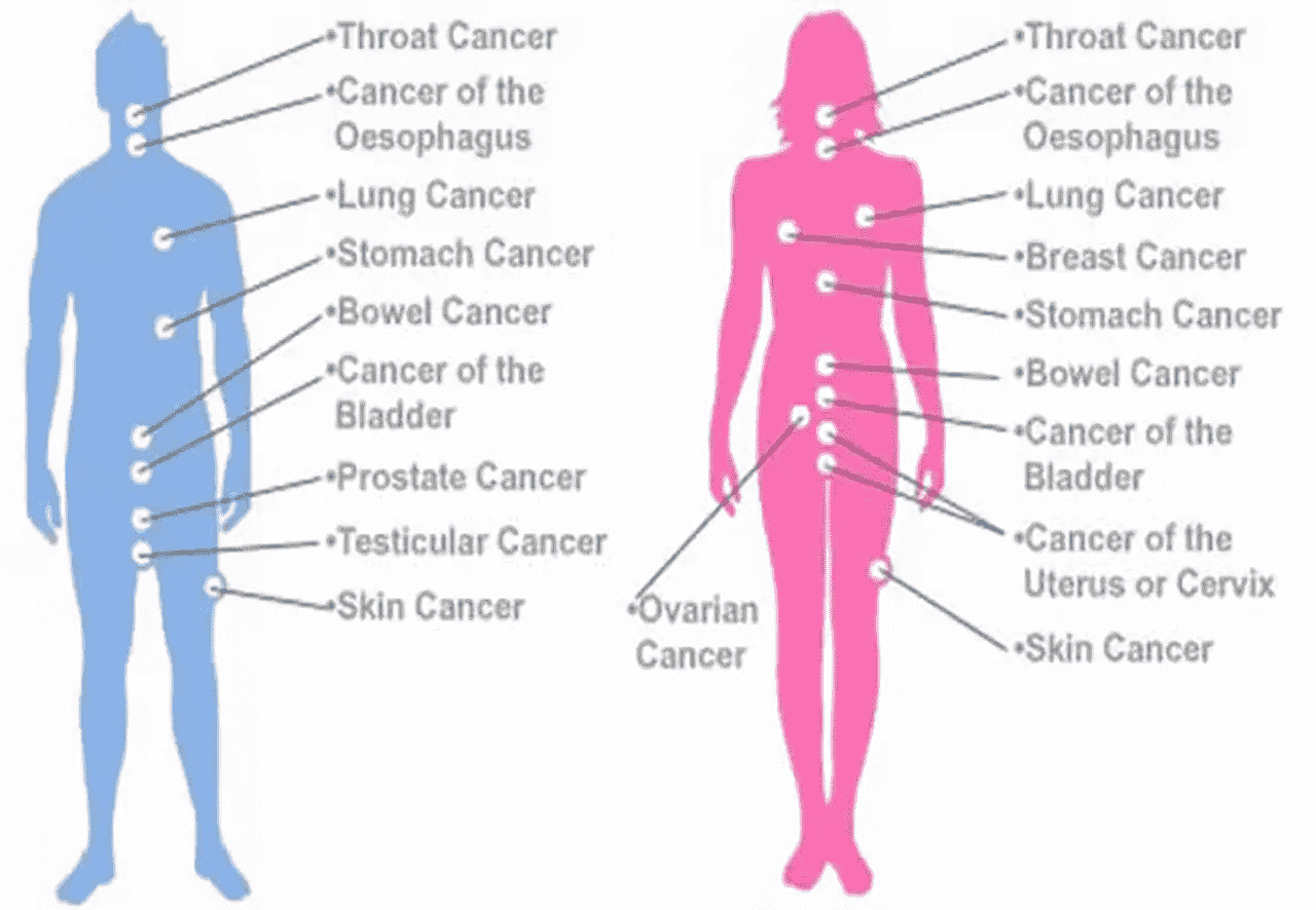 Common cancers in men and women