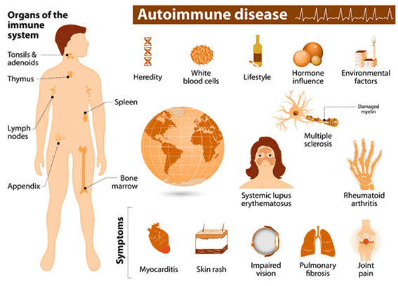 Immune Diseases